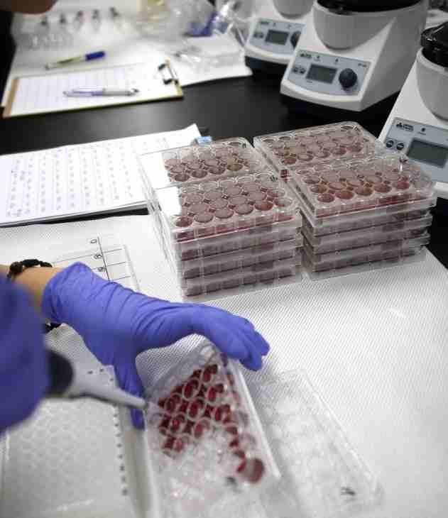 경기도는 가축전염병 예방과 방역 체계 강화를 위해 ‘결핵병 및 브루셀라병 검사 및 검사증명서 휴대 명령’ 고시를 개정했다.